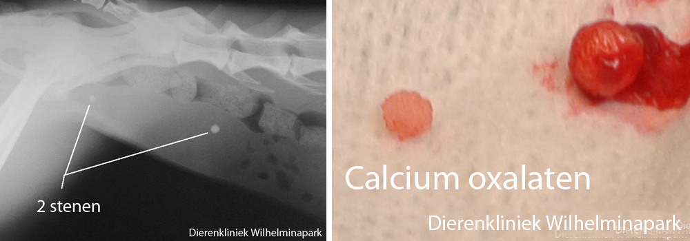 Kat blaassteen operatie, de stenen bestaan uit calcium oxalaten 